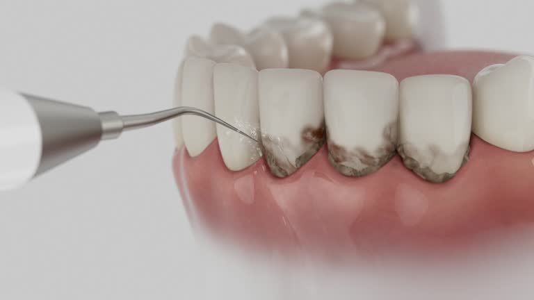 Trusted Dental Crowns And Bridges service in Sherwood, OH - Dentist Open Now